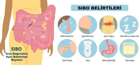 SIBO Nedir?