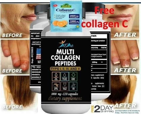 ColÁgeno Hidrolisado Natural Vitamina C | Ubuy India