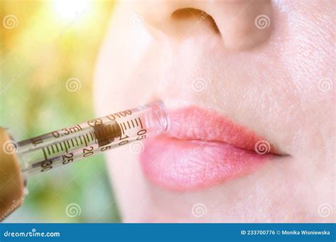 Lip Augmentation Treatment Hyaluron Pen Device Stock Photo - Image of ampoule, face: 233700776