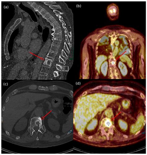 Cancers | An Open Access Journal from MDPI