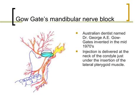 Local Anesthesia Injection Technique 的图像结果
