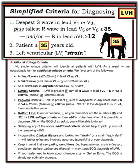 ECG Interpretation: ECG Blog #73 — LVH — Voltage Criteria ...