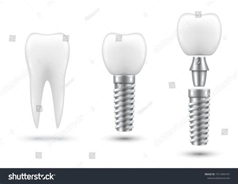 Dental Crowns: Over 13,819 Royalty-Free Licensable Stock Vectors & Vector Art | Shutterstock