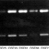 Image result for Reverse Transcriptase PCR