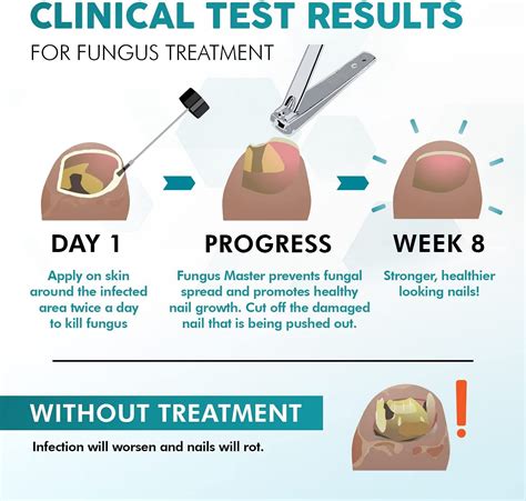 Buy Ebanel Bundle of Foot Fungus Treatment 2 Oz, and Lidocaine Numbing ...