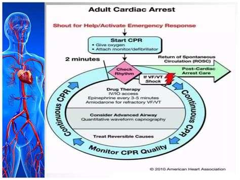 Image result for Controlled Code Blue Management