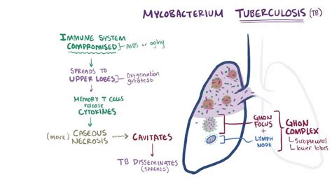 Tuberculosis (TB) - Tuberculosis (TB) - MSD Manual Professional Edition
