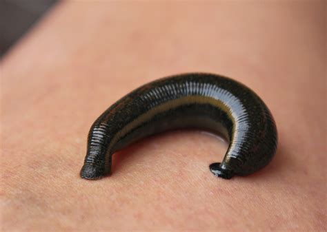 Leech Bites | Nomad Health
