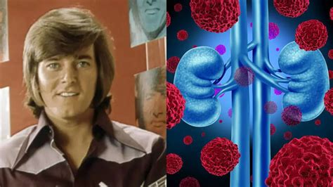 Bobby Sherman Dies After Battling Kidney Cancer At 81; How To Identify ...