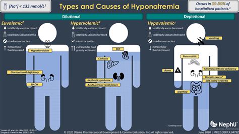 Types & Causes of Hyponatremia - NephU