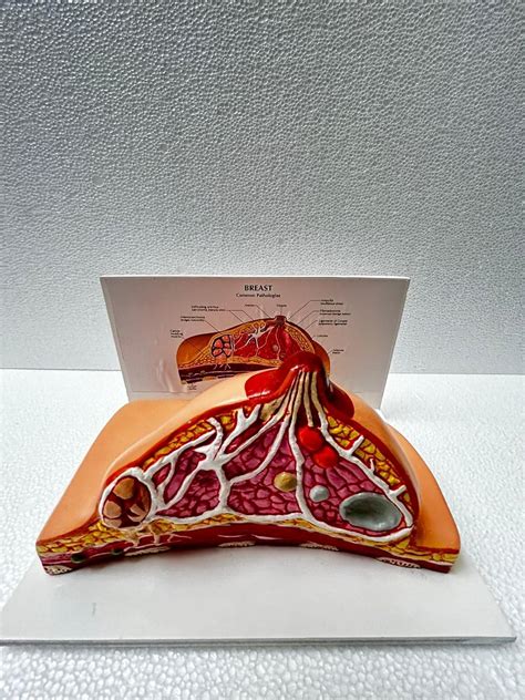 MAXCRADLE BREAST EXAMINATION MODEL| Breast Cross Section Model with ...