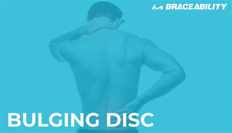 Bulging Disc Example 的图像结果