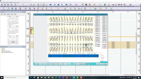 Eaglesoft Tutorials Patient Chart 的图像结果