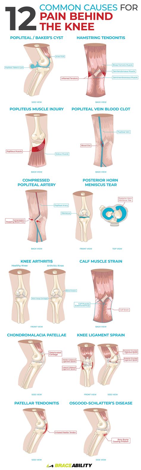 Pulled Muscle Behind Knee And Calf at Sam Lewis blog