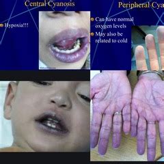 Image result for Examples of Patterns in Digital Image Processing
