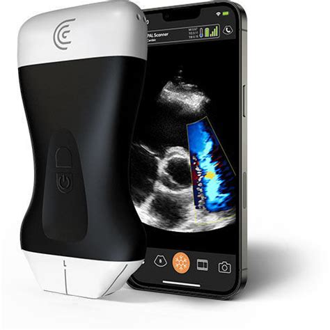 Hand-held ultrasound system - PAL - Clarius Mobile Health - for ...