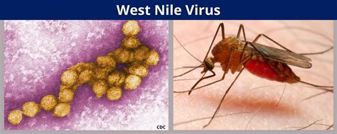 West Nile Virus: Symptoms, Prevention, And Treatment - Complete Guide To The Mosquito-Borne ...