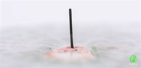 Image result for Freestyle Libre Sensor Hacks