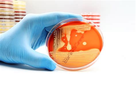 Bacterial Culture, Fungal Culture and Sensitivity Testing