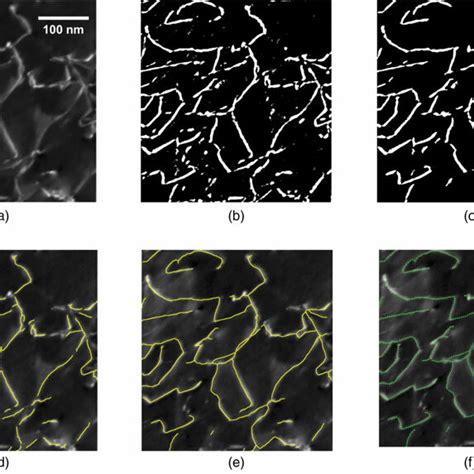 Image result for Dislocation Line