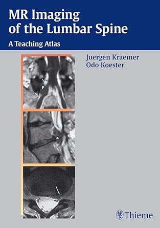 MR Imaging of the Lumbar Spine: A Teaching Atlas eBook : Kraemer ...