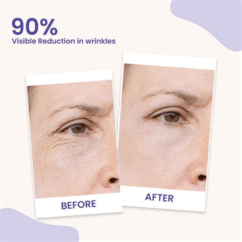 Retinol Cream - Retinol Skincare Products | Earthraga