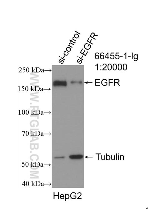 EGFR antibody (66455-1-Ig) | Proteintech