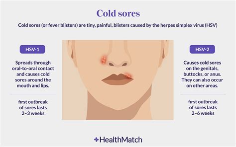 HealthMatch - Herpes: An Unexpected Cancer Therapy