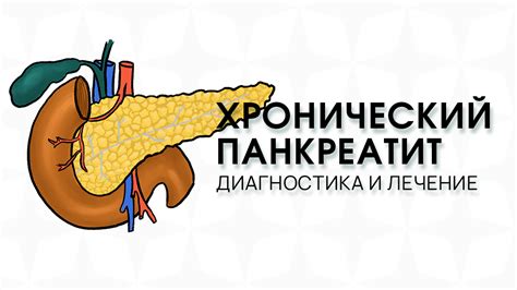 Хронический панкреатит у взрослых - причины, симптомы, лечение
