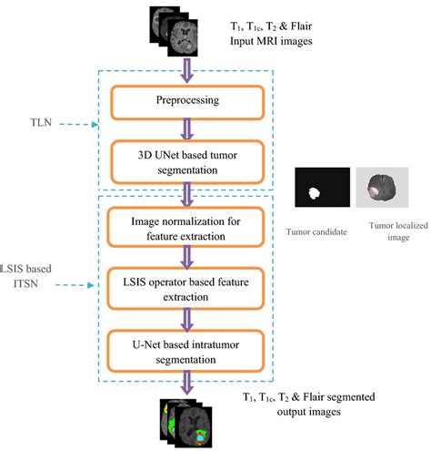 Image result for Tumor Segmentation Using Python