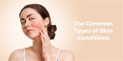 Image result for Different Types of Skin Conditions