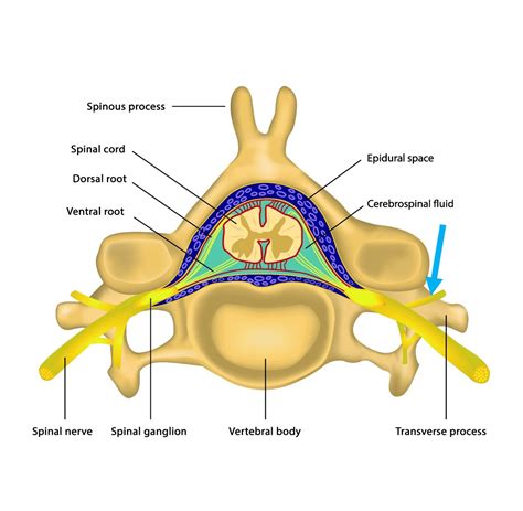 Medial Branch Spine Pain | Medial Branch Block Injections – SRXQ
