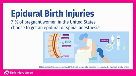 What Are Epidural Shakes at Gail Odom blog