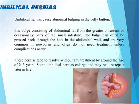 Hernia | PPT