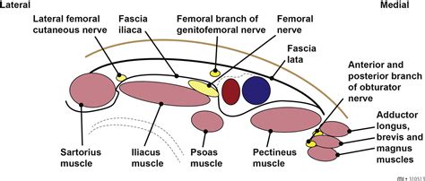 Fascia iliaca compartment block - BJA Education
