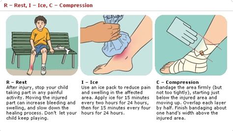 Sprain First Aid 的图像结果