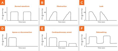 Anesthesia Airway Medicine Given Dog 的图像结果