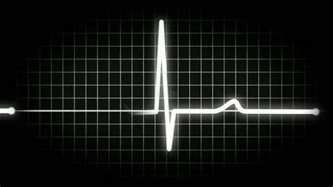 高血压人数近3亿：猝死前的6种感觉 也许能救你一命