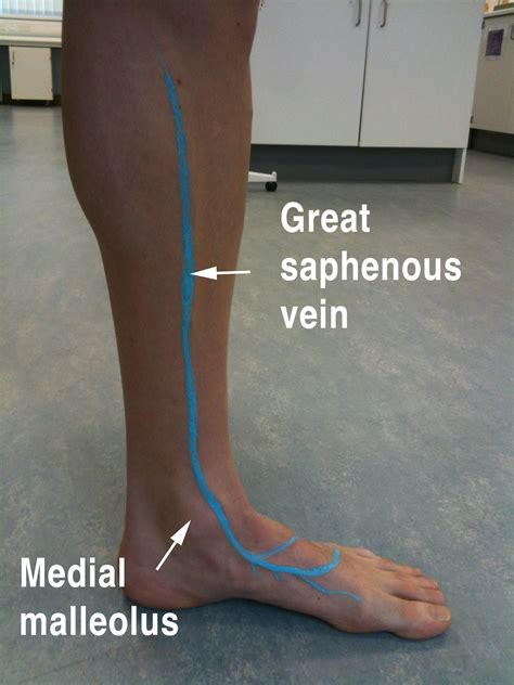 Great Saphenous Vein Anatomy
