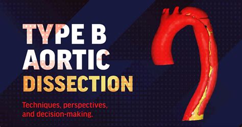 Type B Aortic Dissection: Perspectives, Techniques, and Decision-Making - Endovascular Today