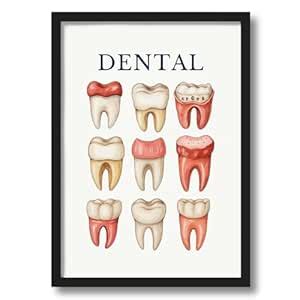 ArtAction Dental Tooth Types Wall Frame Poster | A4 Size Framed Dental ...