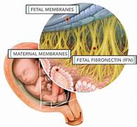 Image result for Fetal Fibronectin Test