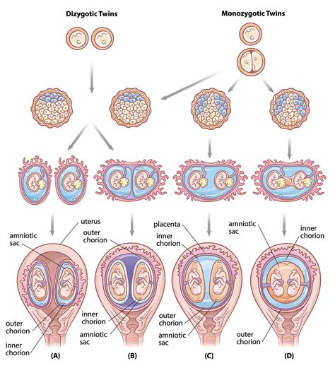 Identical twins and how do they happen?: identical twins conception – Akapv