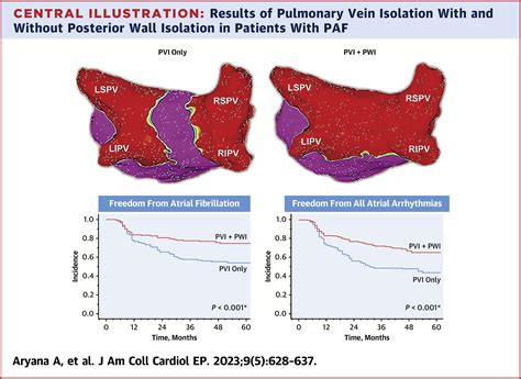 Pulmonary Vein Isolation With and Without Posterior Wall Isolation in Paroxysmal Atrial ...