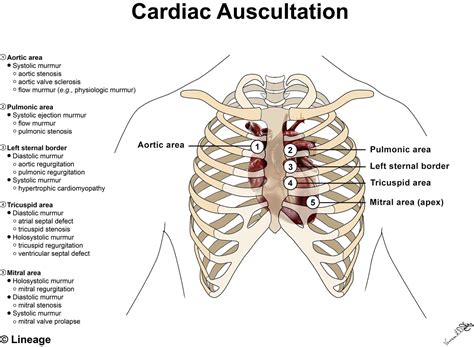 Cardiac Auscultation