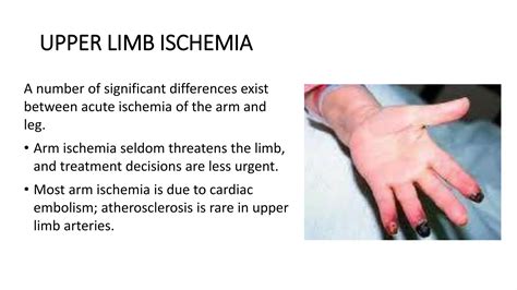 Acute limb ischemia | PPTX