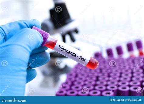 Triglyceride Test To Look for Abnormalities from Blood Stock Photo - Image of biological ...