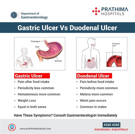 Gastric Ulcer Patient Education