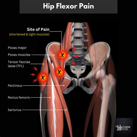 Hip Pain | Root Causes and Relief Exercises