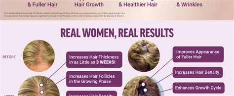 Accelerator Factor 的图像结果